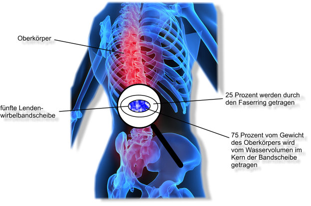Rückenschmerzen unterer Rücken durch Wassermangel im Körper